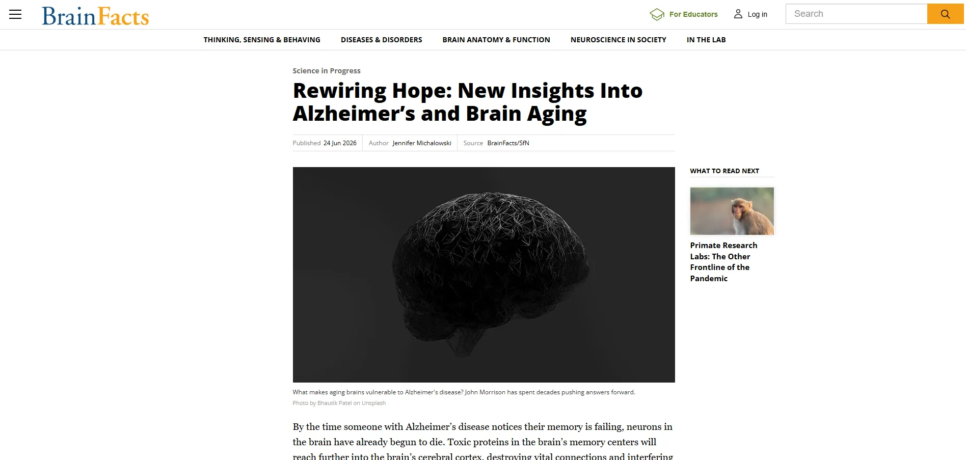 BrainFacts article page titled Rewiring Hope: New Insights Into Alzheimer's and Brain Aging shown on desktop