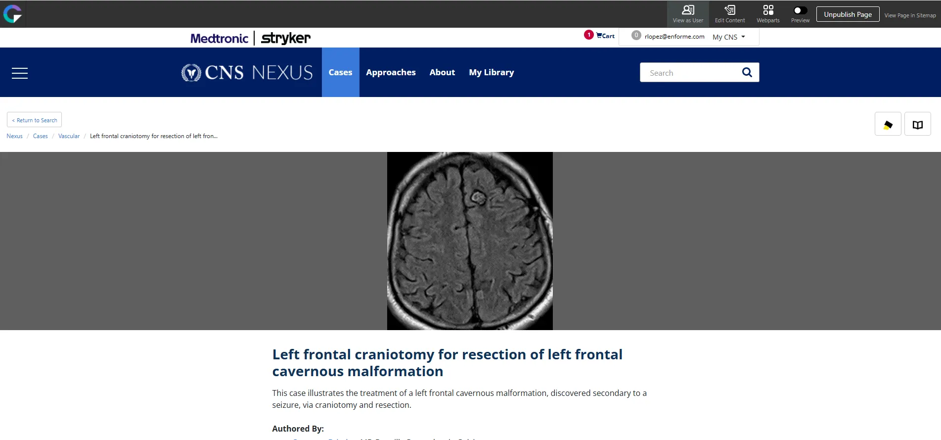 CNS Nexus neurosurgical case detail page with medical imaging and case information